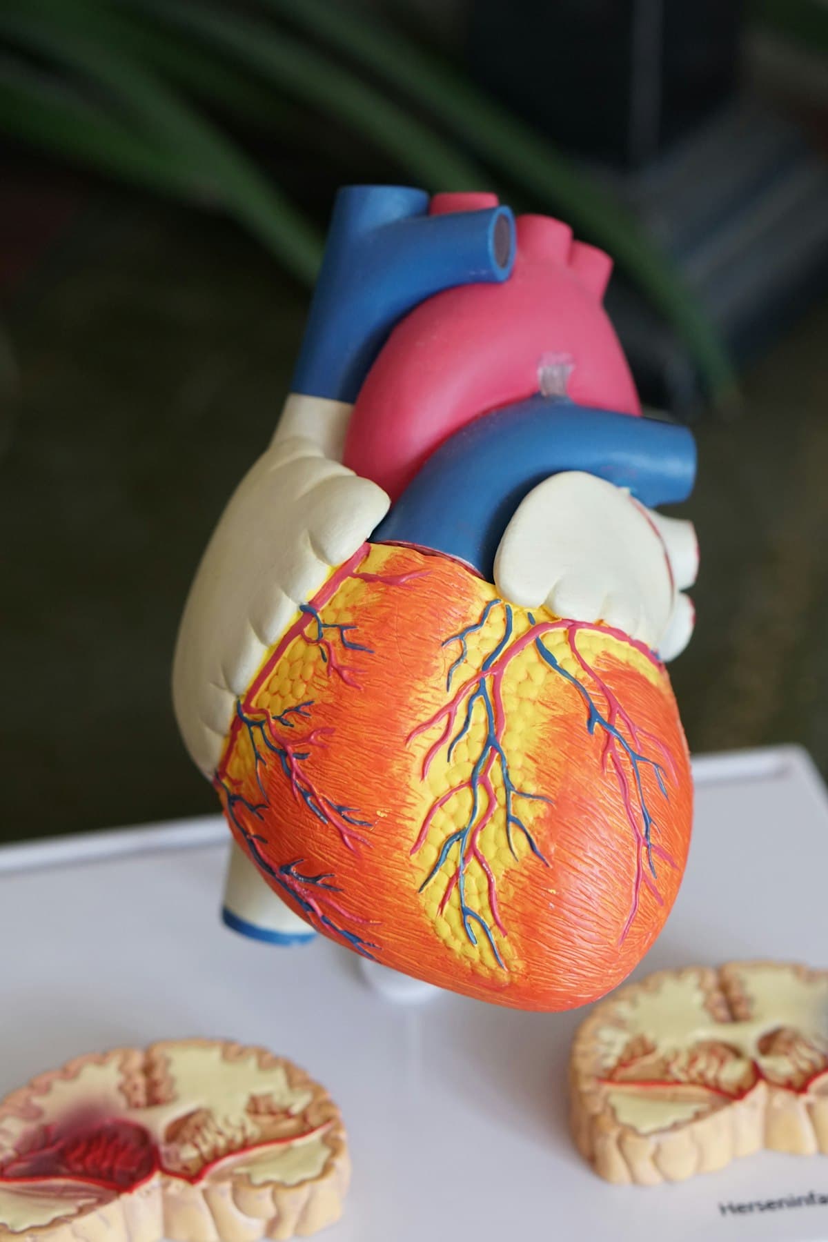 Modèle anatomique de cœur utilisé en consultation de cardiologie